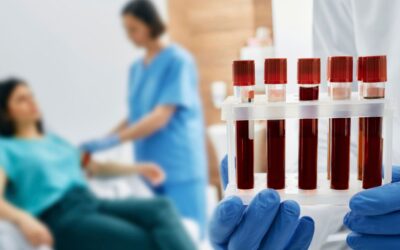 Why Assett Beats Any Lab Test Now for Franchise Buyers